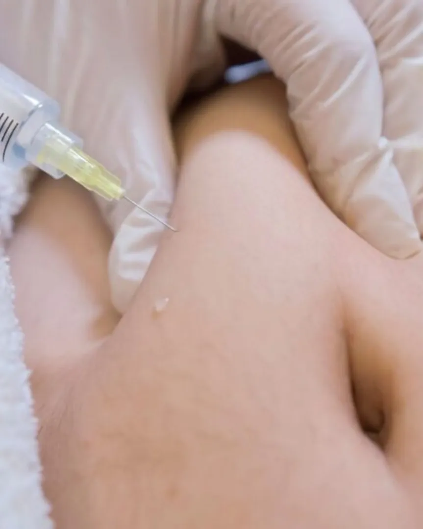 Aqualyx Fat Dissolving Treatment