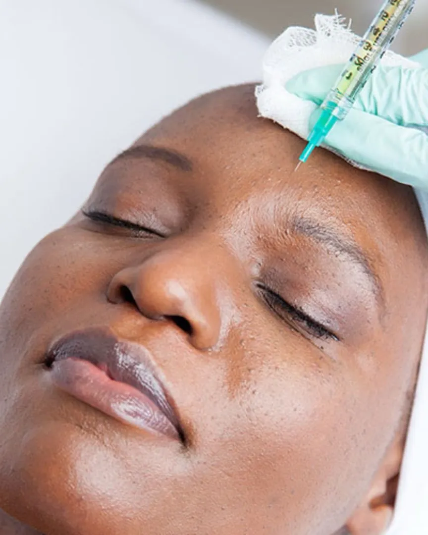 Mesotherapy