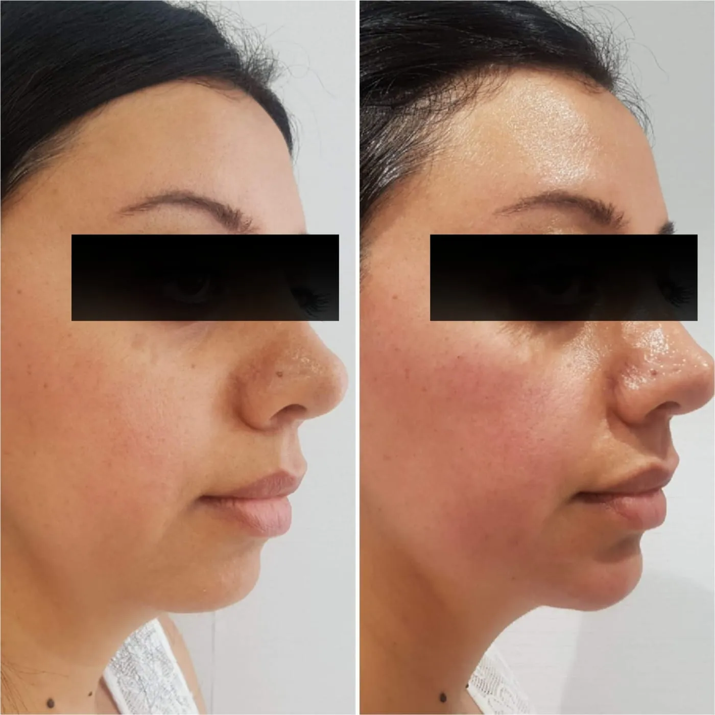 Client transformation 1