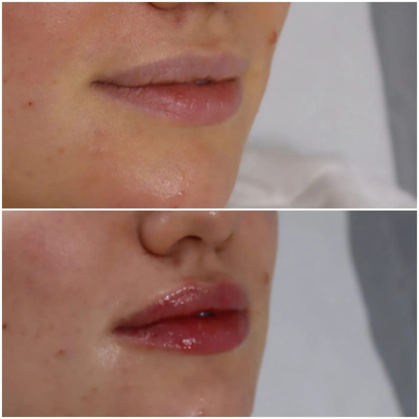 Client transformation 11