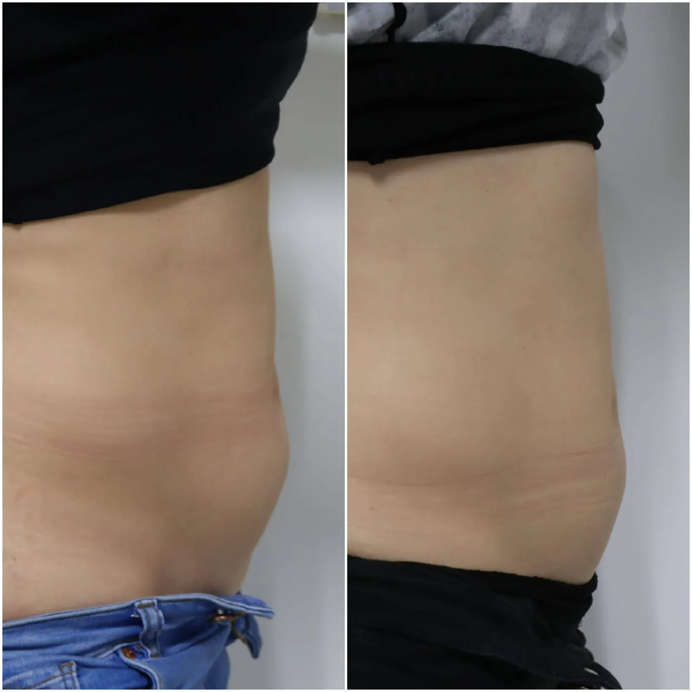 Client transformation 12