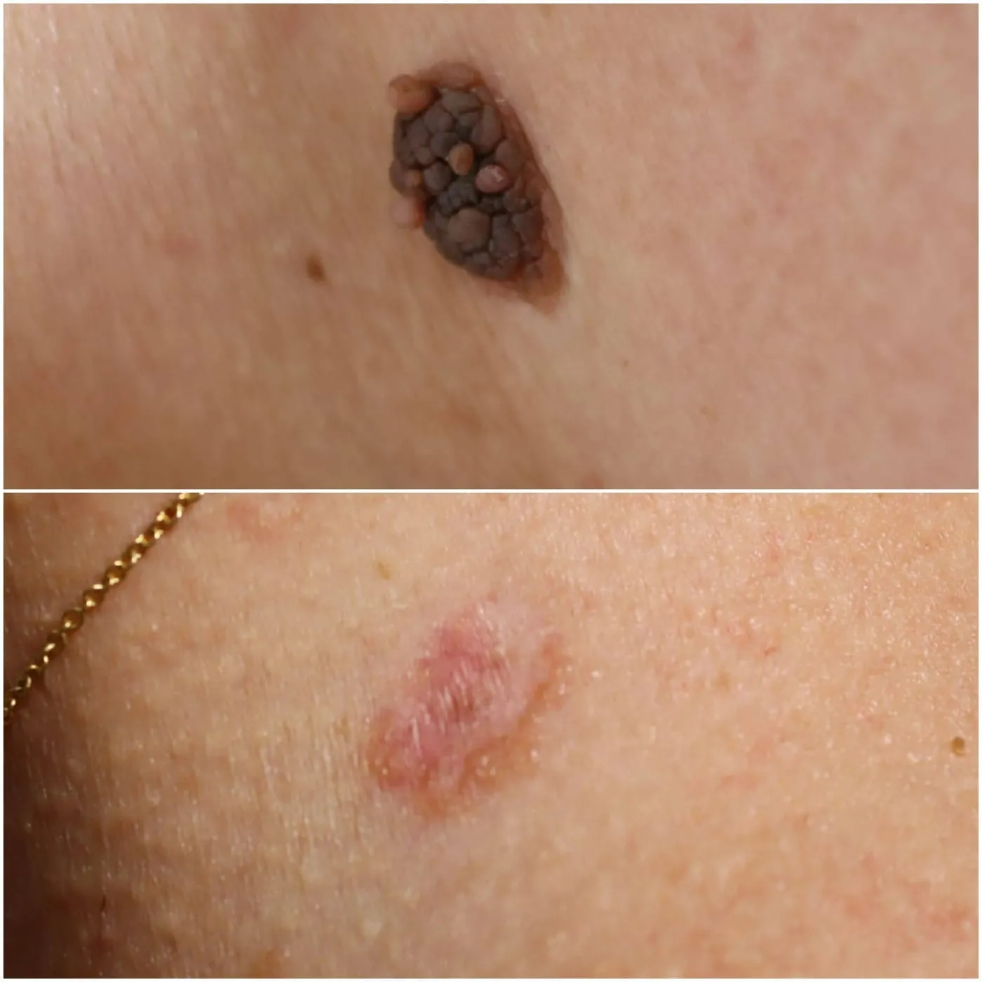 Client transformation 17