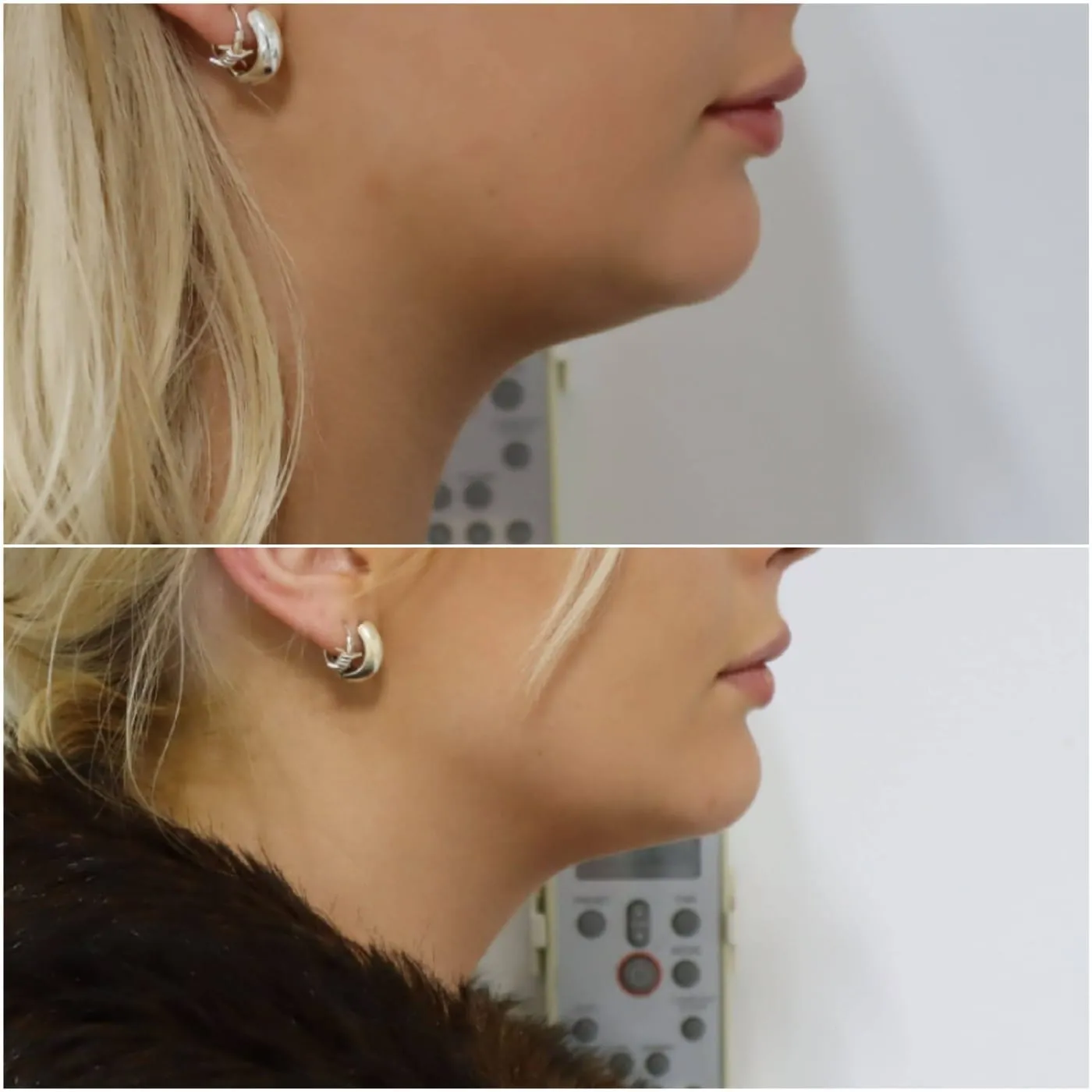 Client transformation 2