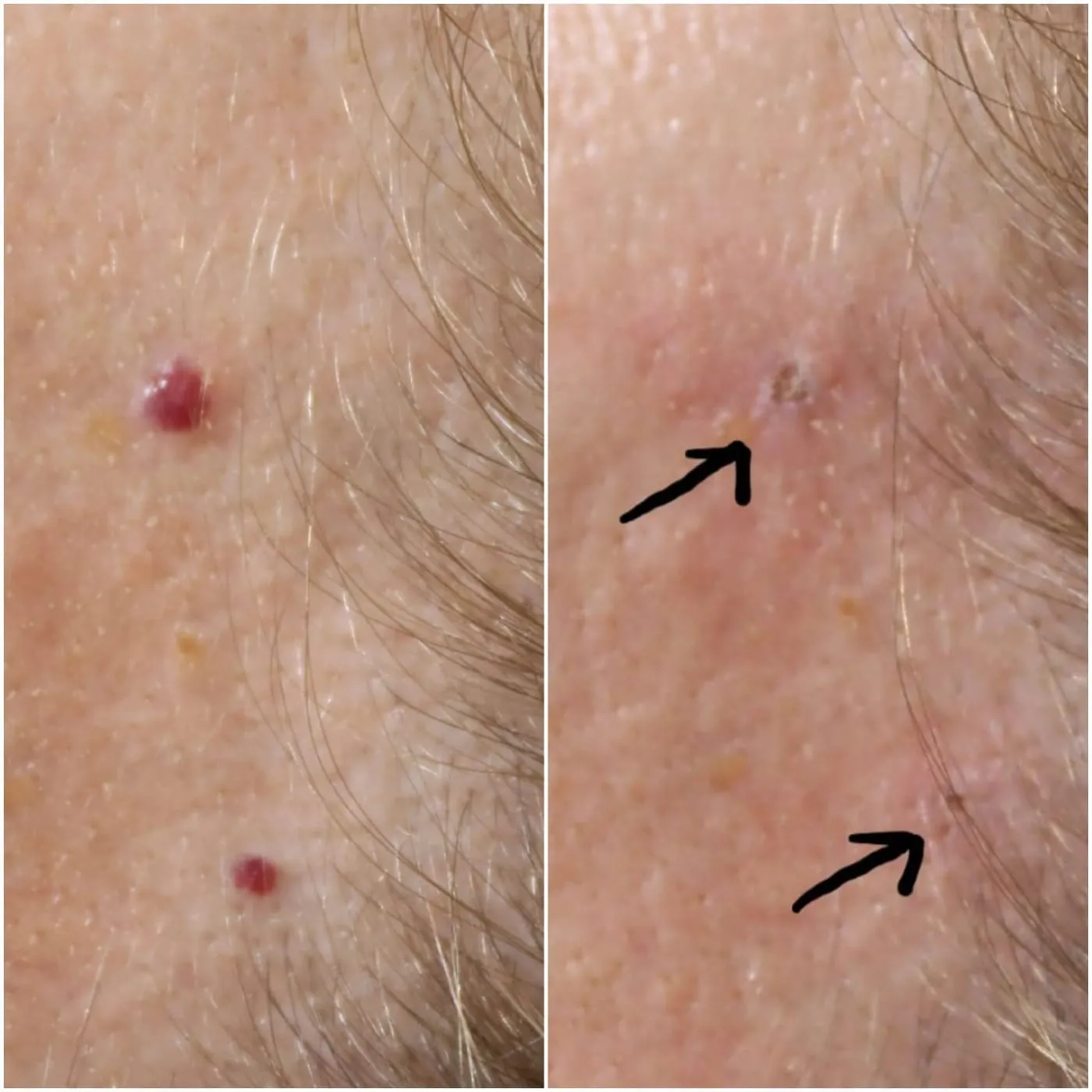 Client transformation 18