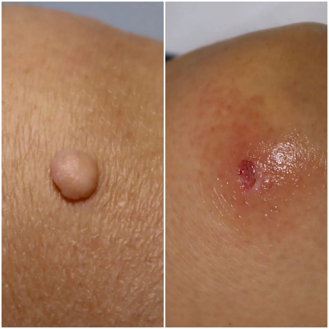 Client transformation 19