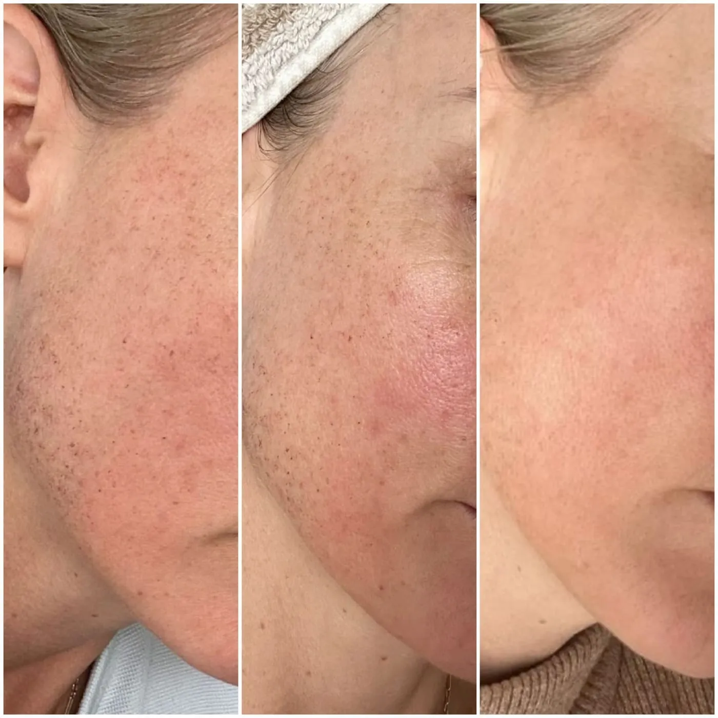 Client transformation 5