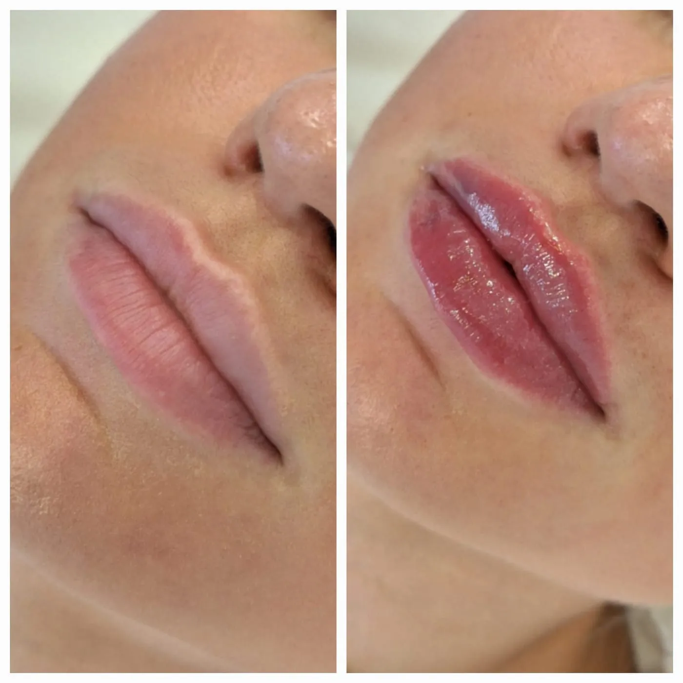 Client transformation 7