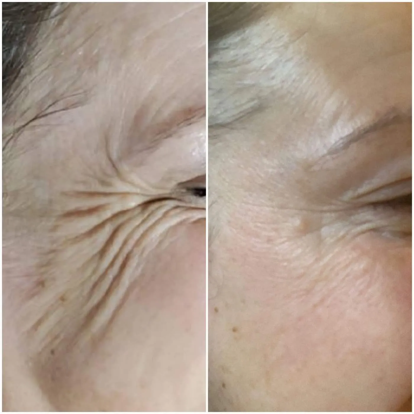 Client transformation 8